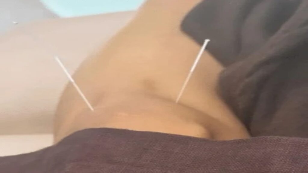 Samantha Suffers Knee Injury